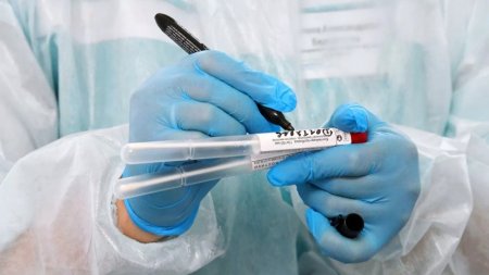 Rusiya telekanalının 16 əməkdaşı koronavirusa yoluxdu