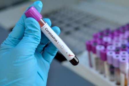 İspaniyada son sutkada koronavirusdan 244 nəfər vəfat edib