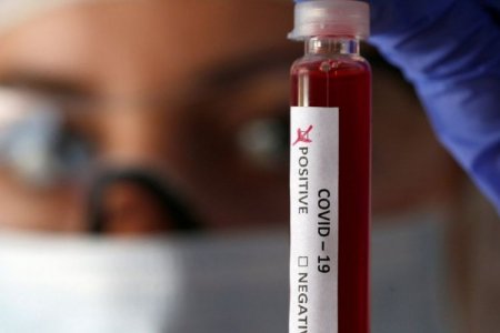İranda son sutkada koronavirusdan 48 nəfər ölüb