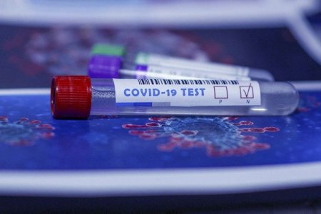 Azərbaycanda indiyədək 2 380 074 koronavirus testi aparılıb