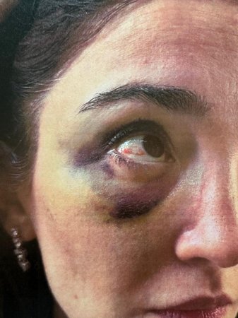 Məzahir Pənahovun oğlu arvadına işgəncə verib - Məzahir Pənahovun oğlu arvadına işgəncə verib -