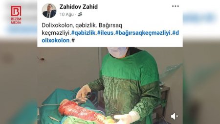 Cərrah Zahid Zahidovun əməliyyat görüntülərini paylaşması ilə bağlı  